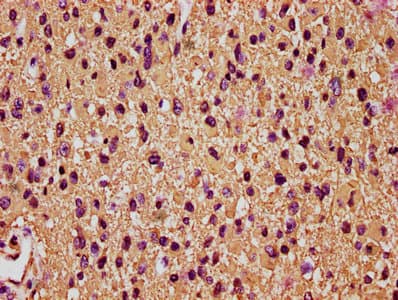 GFAP Antibody