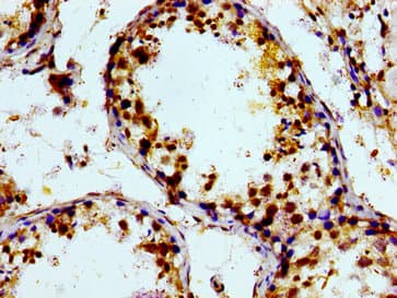 PTGR2 / PGR2 Antibody