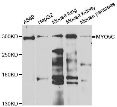 IHC-plus™ Polyclonal Rabbit anti-Human MYO5C Antibody (IHC, WB)