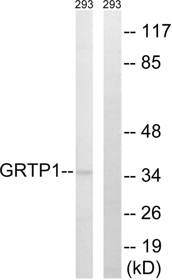 Polyclonal Rabbit anti-Human GRTP1 Antibody (aa71-120, WB)