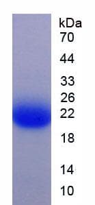 Human YWHAZ / 14-3-3 Zeta Protein (Recombinant His)