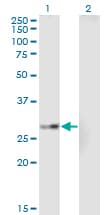 EPHA7 / EPH Receptor A7 Antibody (clone 1G11)