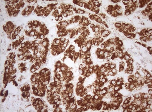 DECR1 Antibody (clone OTI5D12)