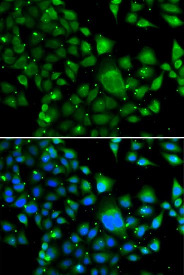 Polyclonal Rabbit anti-Human WBSCR22 Antibody (IHC, IF, WB)