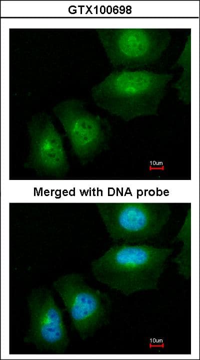 Polyclonal Rabbit anti-Human Calgizzarin / S100A11 Antibody (aa8-102, IHC, WB)