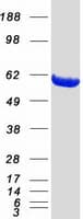 Human PPM1B Protein (Recombinant Myc-DDK (Flag))