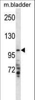 Polyclonal Rabbit anti-Human TMPRSS7 Antibody (aa103-132, WB)
