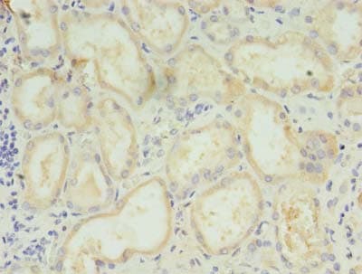 Polyclonal Rabbit anti-Human LYPLAL1 Antibody (IHC)