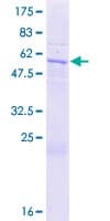 Human MTG1 / Mitochondrial GTPase 1 Protein (Recombinant GST)