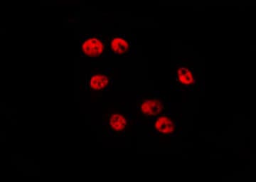 Polyclonal Rabbit anti-Human UBE2T / HSPC150 Antibody (IF, WB)