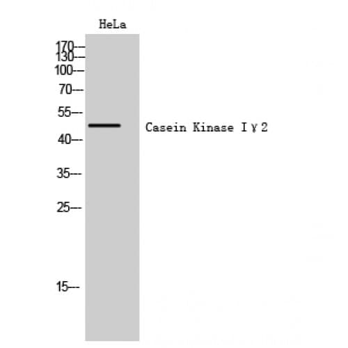 CSNK1G2 / CKI-Gamma 2 Antibody (10-90 aa, N-terminal)