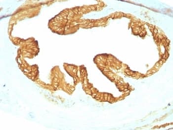 Pan Cytokeratin Antibody (clone KRTL/1077 + KRTH/1076)