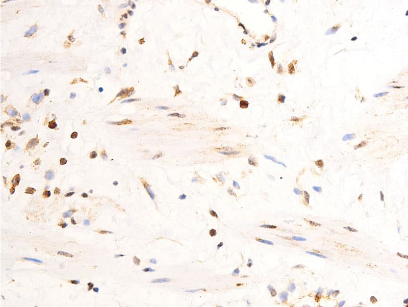 Polyclonal Rabbit anti-Human JUN / c-Jun Antibody (phospho-Tyr170, IHC, WB)