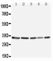 TNFAIP8L3 Antibody (aa273-292)
