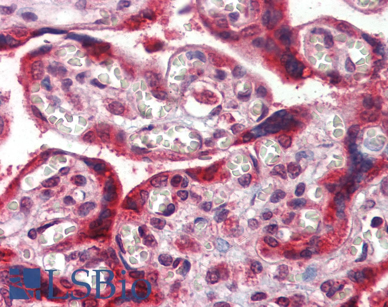 IHC-plus™ TMC8 / EVER2 Antibody