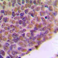 Polyclonal Rabbit anti-Human BRCA1 Antibody (C-Terminus, IHC, WB)