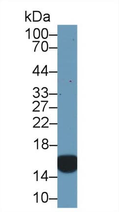 CRABP2 Antibody (aa1-138, PE)