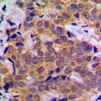 STAT5A Antibody (C-Terminus)