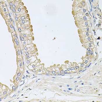 ANKH Antibody