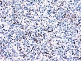 Monoclonal Mouse anti-Human CNN2 Antibody (clone OTI2B5, IHC, IF, WB)
