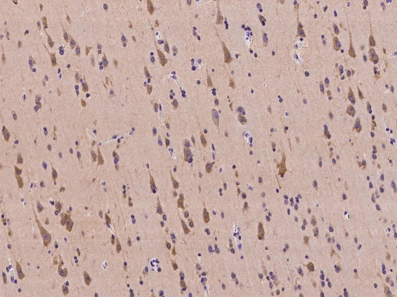 Polyclonal Rabbit anti-Human TARBP2 / TRBP2 Antibody (IHC)