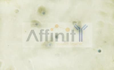 Polyclonal Rabbit anti-Human CaMKII Beta+Gamma+Delta Antibody (phospho-Thr287, IHC, WB)