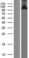 BCL11B Protein (Over-Expression Lysate Myc-DDK (Flag))