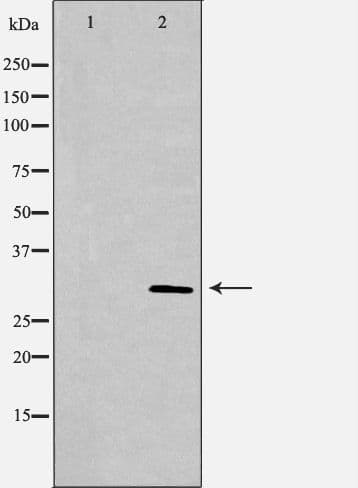 PSME3 Antibody