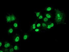 LOX / Lysyl Oxidase Antibody (clone OTI9G2)