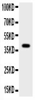 Polyclonal Rabbit anti-Human CTSB / Cathepsin B Antibody (aa80-333, WB)