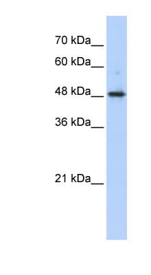 Polyclonal Rabbit anti-Human ABHD2 Antibody (aa351-400, WB)