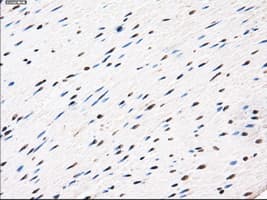 AKR1A1 Antibody (clone OTI2E7)