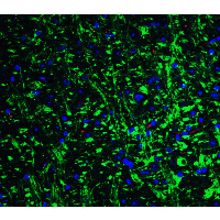 IHC-plus™ GRIK1 / GLUR5 Antibody
