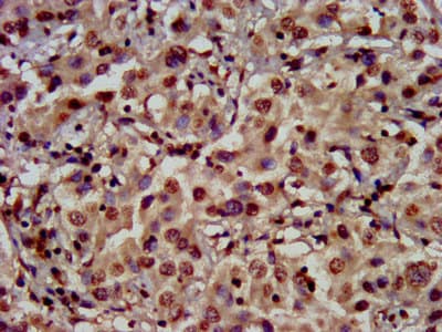 Polyclonal Rabbit anti-Human HIST1H3A Antibody (IHC)