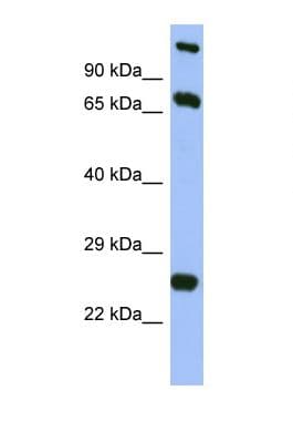 Polyclonal Rabbit anti-Human TBC1D7 Antibody (aa111-160, WB)