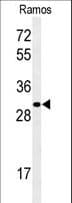 Polyclonal Rabbit anti-Human GBAS Antibody (aa130-159, IHC, WB)