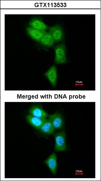 PSMB8 / LMP7 Antibody (aa52-276)