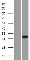 TLCD2 Protein (Over-Expression Lysate Myc-DDK (Flag))