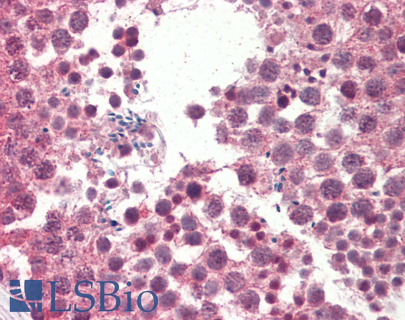 IHC-plus™ Polyclonal Goat anti-Human IGFBP1 Antibody (aa238-252, IHC, WB)