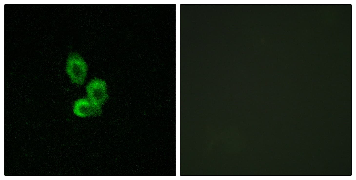 PDGFRB / PDGFR Beta Antibody (aa718-767)