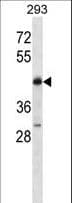 BRN3B / POU4F2 Antibody (aa311-339)