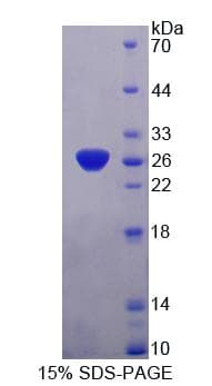 Human PCDHA1 Protein (Recombinant His-T7)