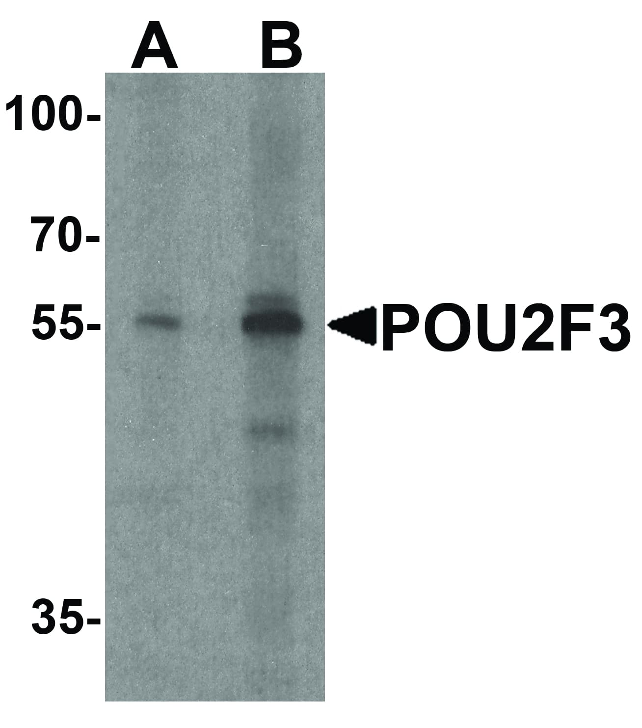 Polyclonal Rabbit anti-Human POU2F3 / PLA-1 Antibody (IHC, IF, WB)