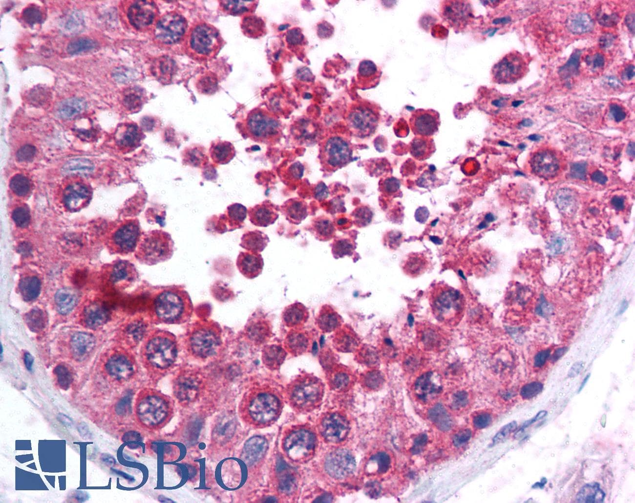 IHC-plus™ PPP6C Antibody