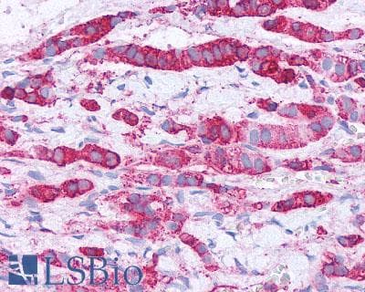 PathPlus™ Polyclonal Rabbit anti-Human CRHR2 / CRF2 Receptor Antibody (Extracellular Domain, IHC)