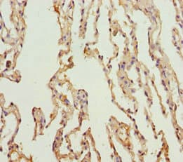 KCNS3 Antibody