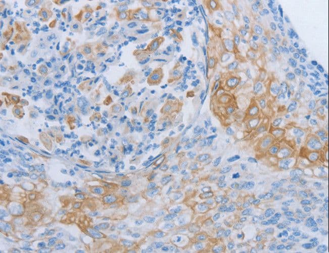 Polyclonal Rabbit anti-Human ADRB3 Antibody (IHC)