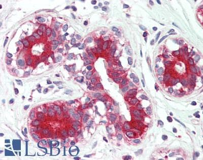 IHC-plus™ ATP6V1B1 Antibody (aa1-280)