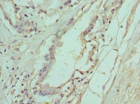 IL11RA Antibody (aa30-290)