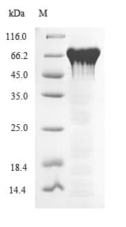 Mouse PPARG / PPAR Gamma Protein (Recombinant 6His-SUMO, N-terminus)
